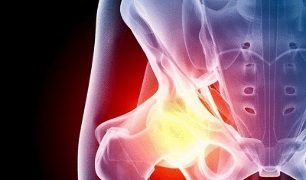причины развития остеоартроза тазобедренного сустава